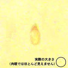 写真:実際の大きさとの比較